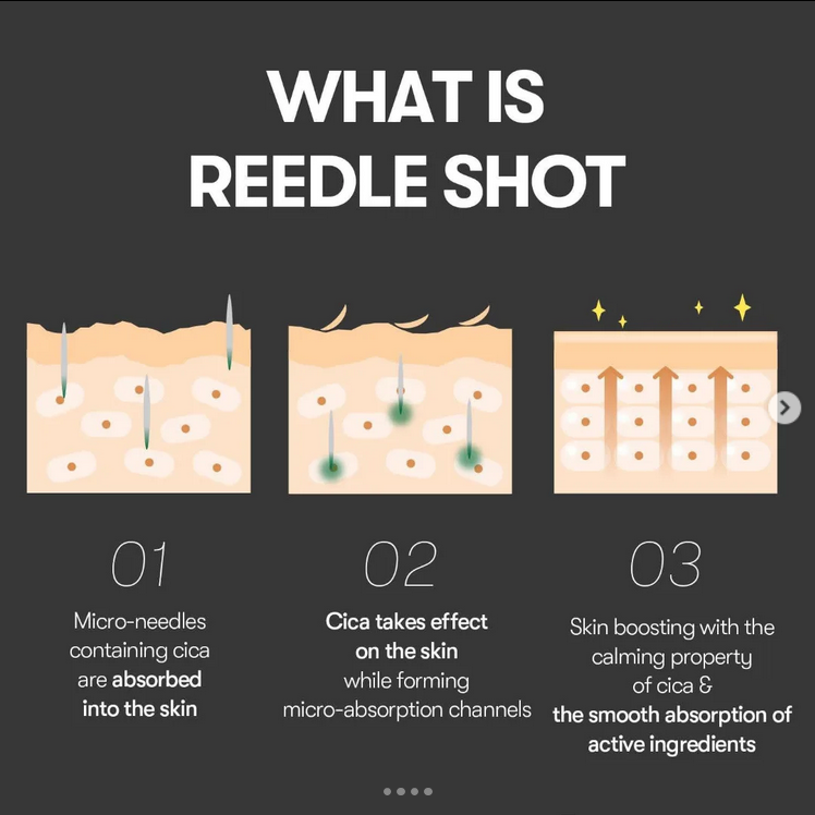 VT Reedle Shot 300 - immagine 5
